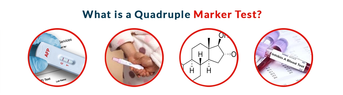 What is a Quadruple Marker Test
